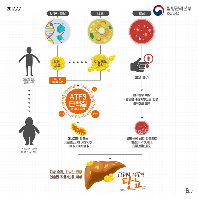 dna형질 세포 혈관 비만세포 비만세포증식 혈당증가 atf3단백질 더많이생산 면역반응 이상 혈당을 중성지방으로 합성 끈적해진 혈액 에너지를 만드는 미토콘드리아 기능저하 에너지 대사율 혈관벽에생긴염증으로 혈관이 막히거나 터질 위험즐가 지방축적, 지방간탄생 인슐린작용/반응 이상 T2DM 제2형 당뇨