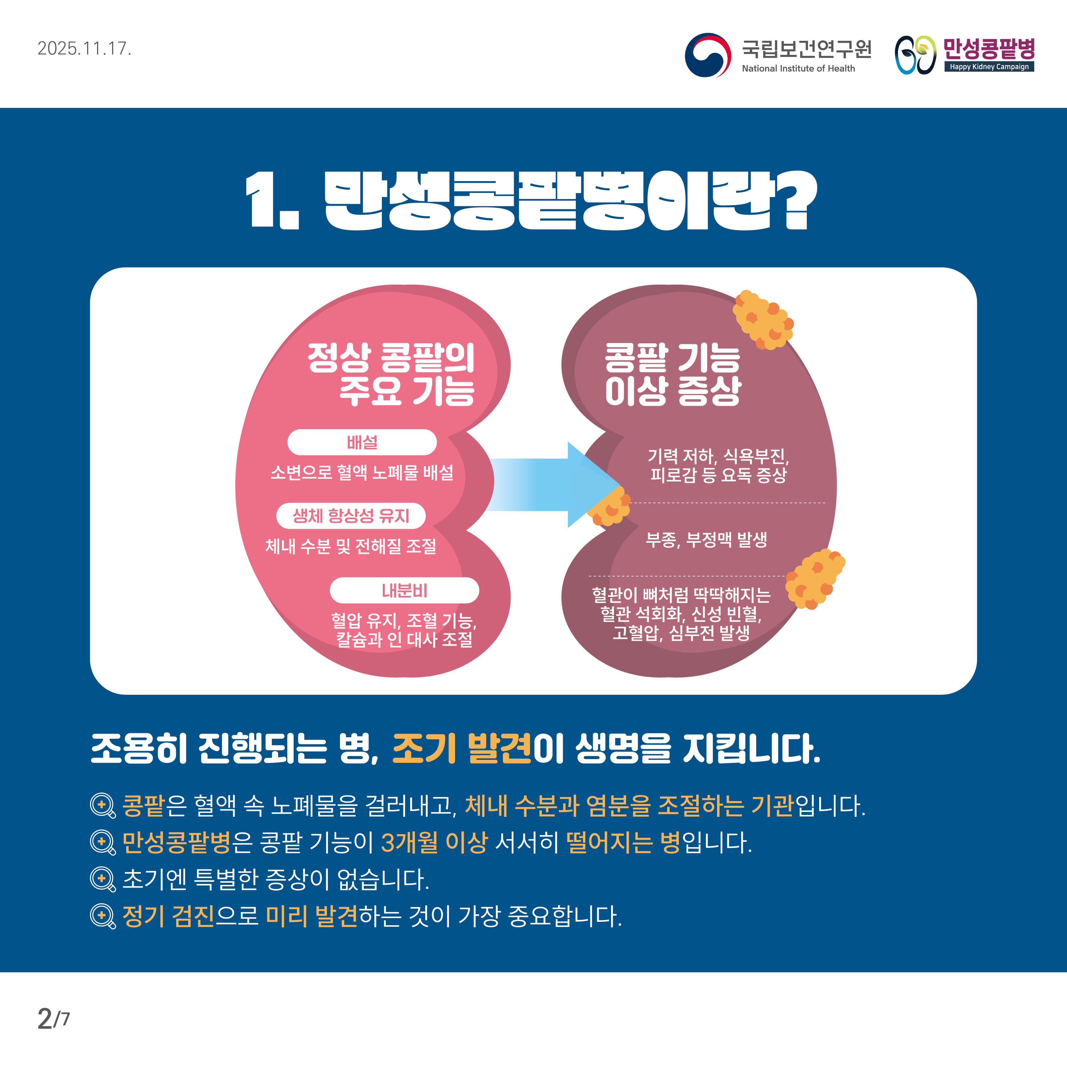 만성 콩팥병의 정상 기능과 이상 증상을 설명하는 이미지. '정상 콩팥의 주요 기능'으로는 배설(소변으로 혈액 노폐물 배출), 생체 활성 유지, 체내 수분 및 전해질 조절, 내분비(혈압 유지, 조혈 기능, 칼슘과 인 대사 조절)가 있다. '콩팥 기능 이상 증상'으로는 기억력 저하, 식욕부진, 피로감 등 요독 증상과 부종, 부정맥 발생, 혈관이 딱딱해지는 혈관 석회화, 신성 빈혈, 고혈압, 심부전 발생이 있다. 하단에는 콩팥은 혈액 속 노폐물을 거르고 체내 수분과 염분을 조절하며, 만성콩팥병은 콩팥 기능이 3개월 이상 서서히 떨어지는 병으로, 조기 발견이 중요함을 강조한다.