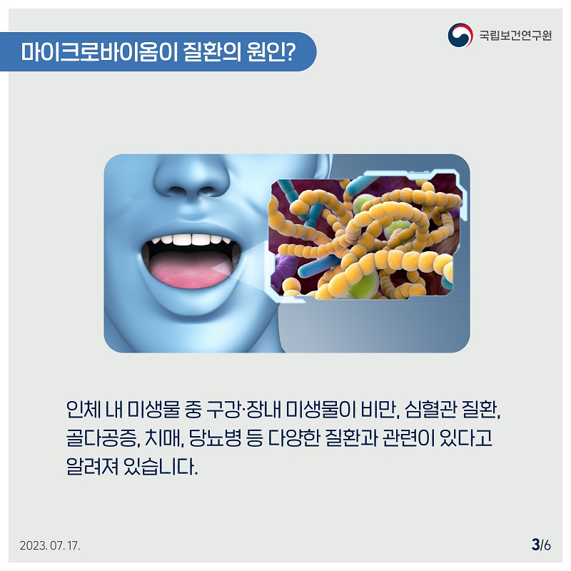 국립보건연구원 / 마이크로바이옴이 질환의 원인? / 인체 내 미생물 중 구강·장내 미생물이 비만, 심혈관 질환, 골다공증, 치매, 당뇨병 등 다양한 질환과 관련이 있다고 알려져 있습니다. 2023.07.17. 3/6