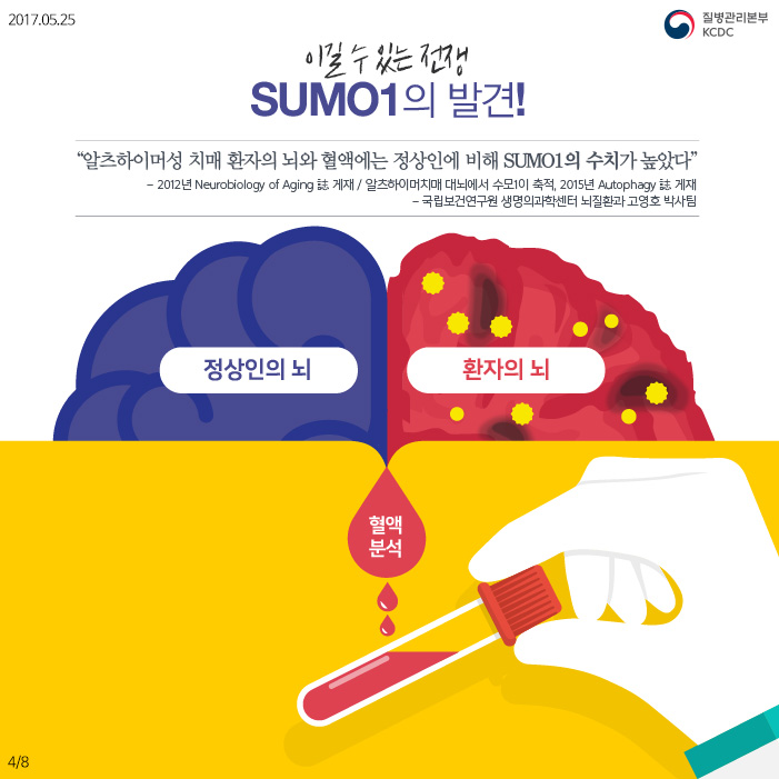 이길 수 있는 전쟁 SUMO1의 발견! 